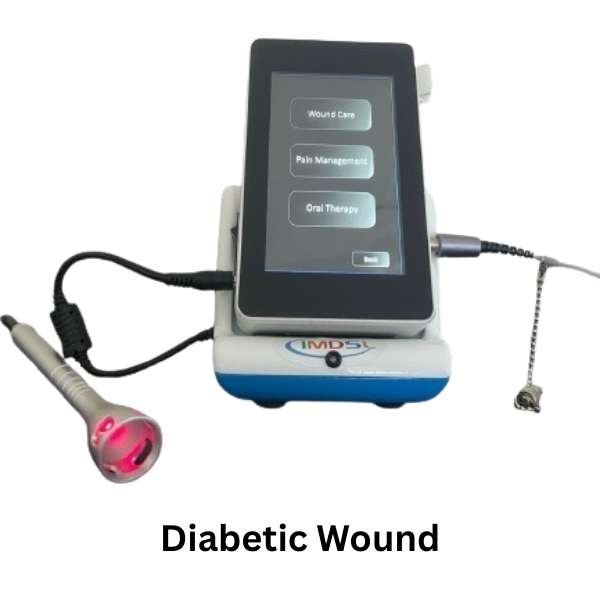Diabetic Wound